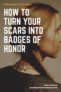 How To Turn Your Scars Into Badges Of Honor